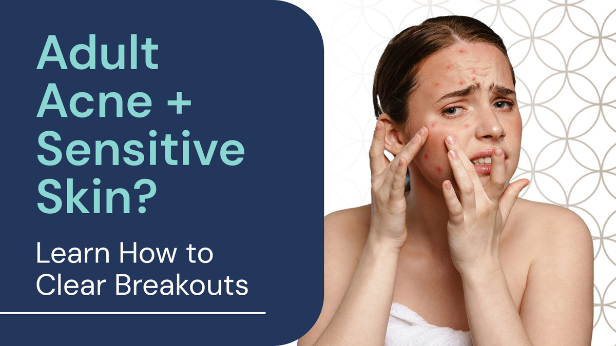 Adult Acne + Sensitive Skin? Learn How to Clear Breakouts Without Irritation